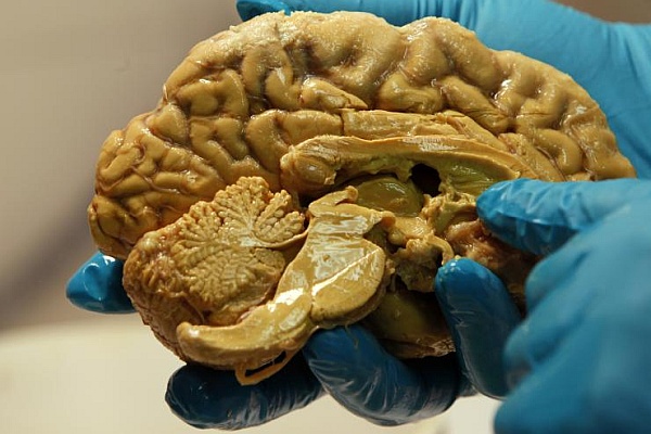 [Image: brainhand.jpg]