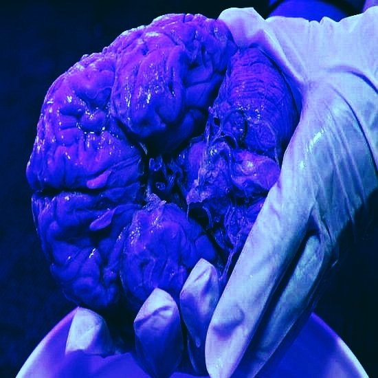 [Image: holdingbrain.jpg]