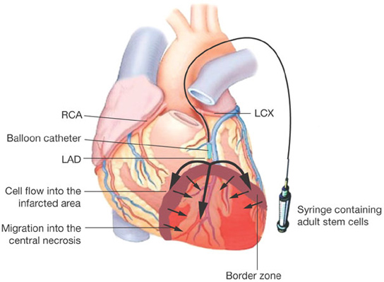 [Image: heart.jpg]
